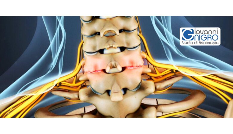 Artrosi cervicale, cos’è e come trattarla